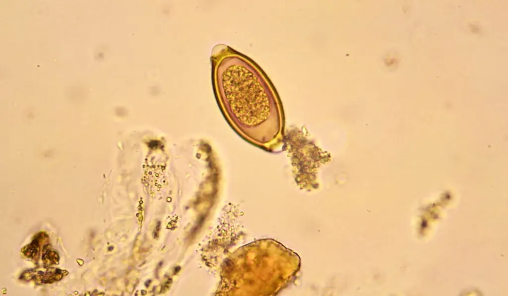 Egg of (Trichuris trichiura) whipworm